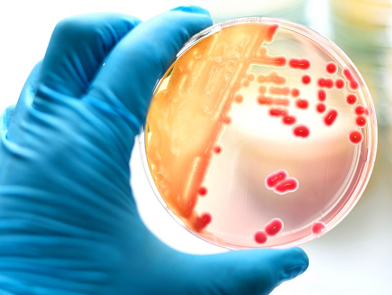 خواص بسیار عالی گزانگبین، خاصیت ضدمیکروبی